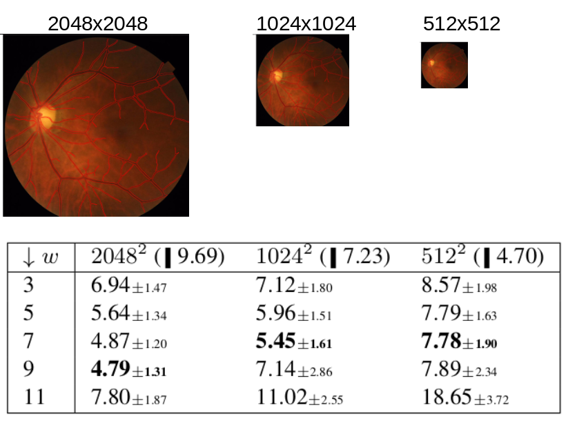 Sensitivity analysis