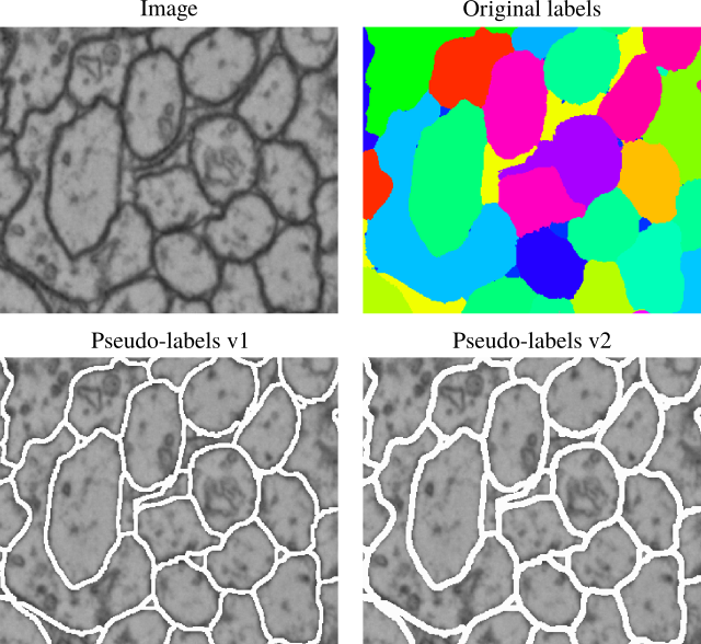 CREMI dataset